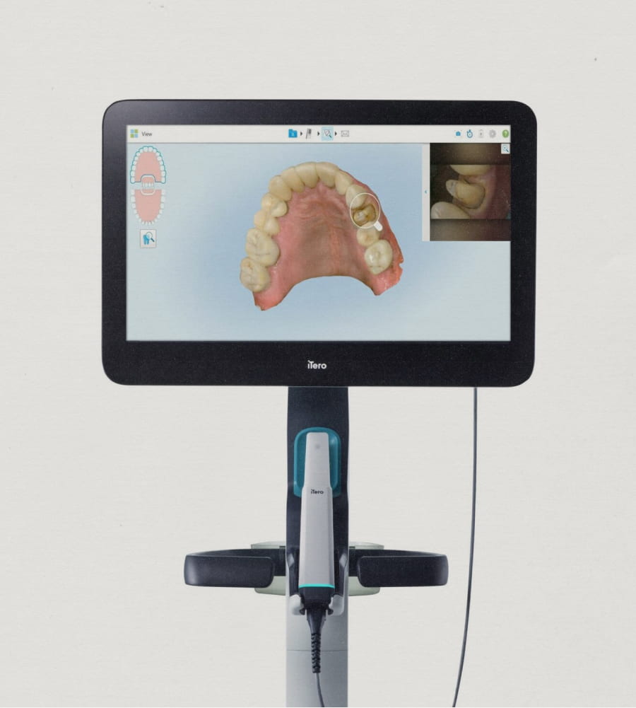 Clinica_Periodontia_Itero_Lumina_Scanner_Intraoral_ 