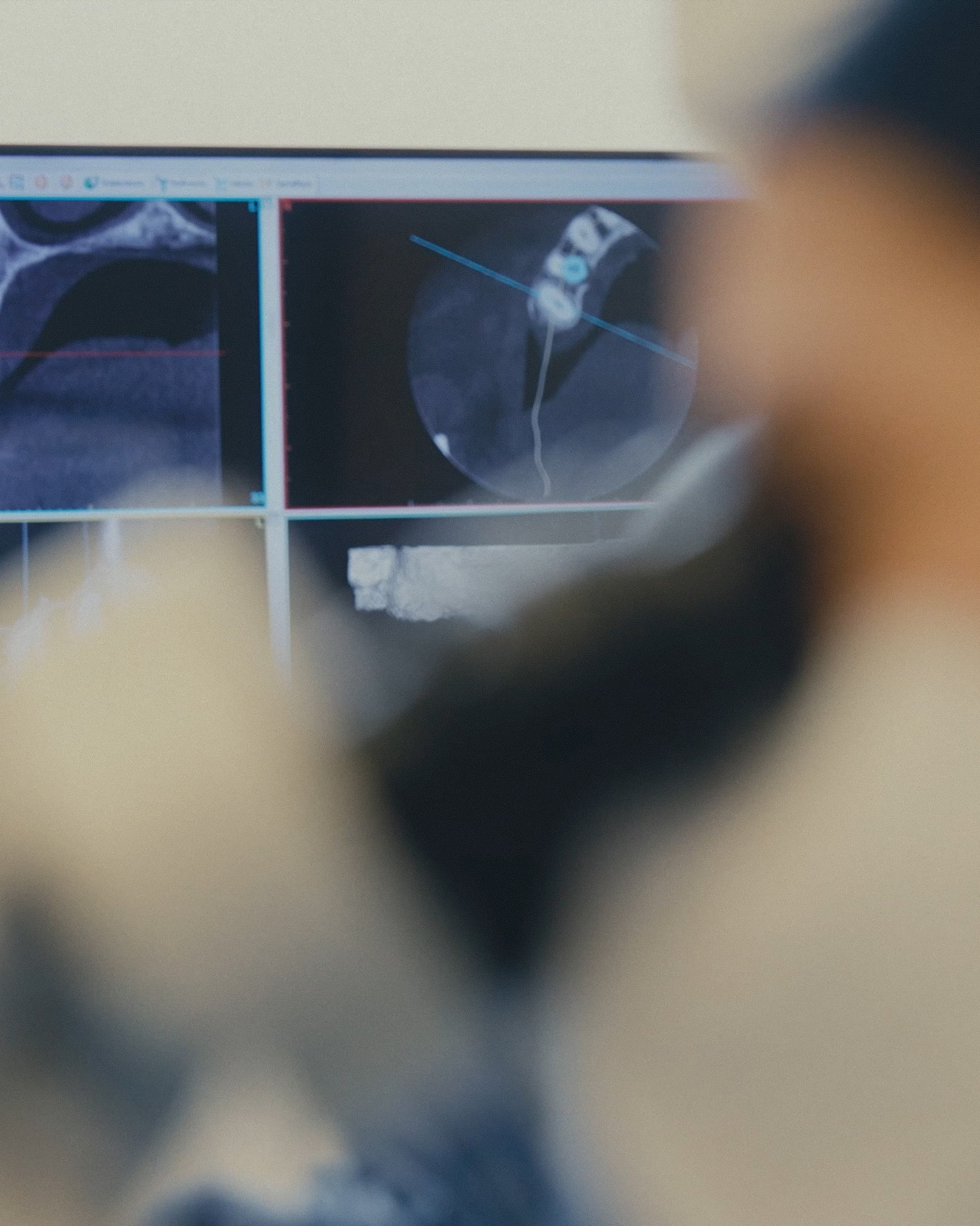 Clinica_Periodontia_Tratamiento_Implantes_03 