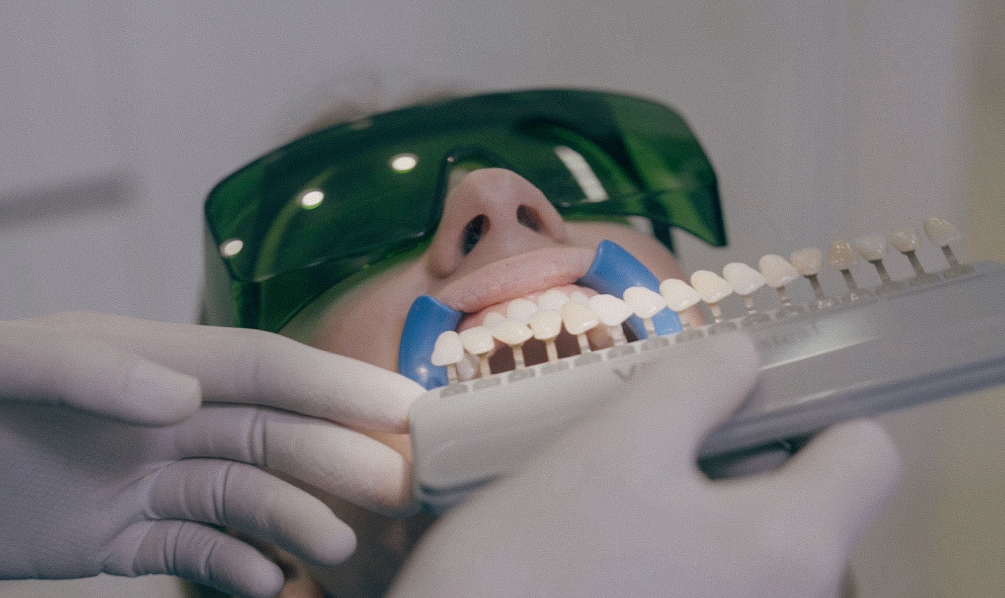 Clinica_Periodontia_Tratamiento_Estetica_Dental_021_movil 